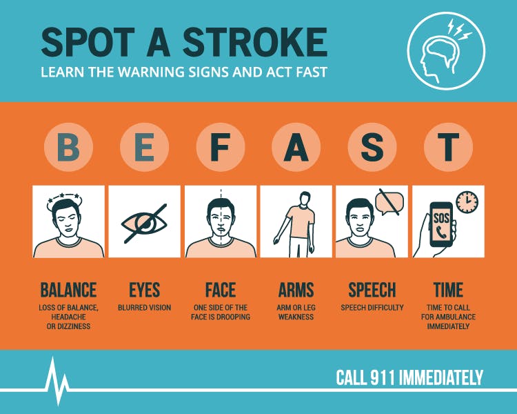 Featured image for “Signs of a Stroke”