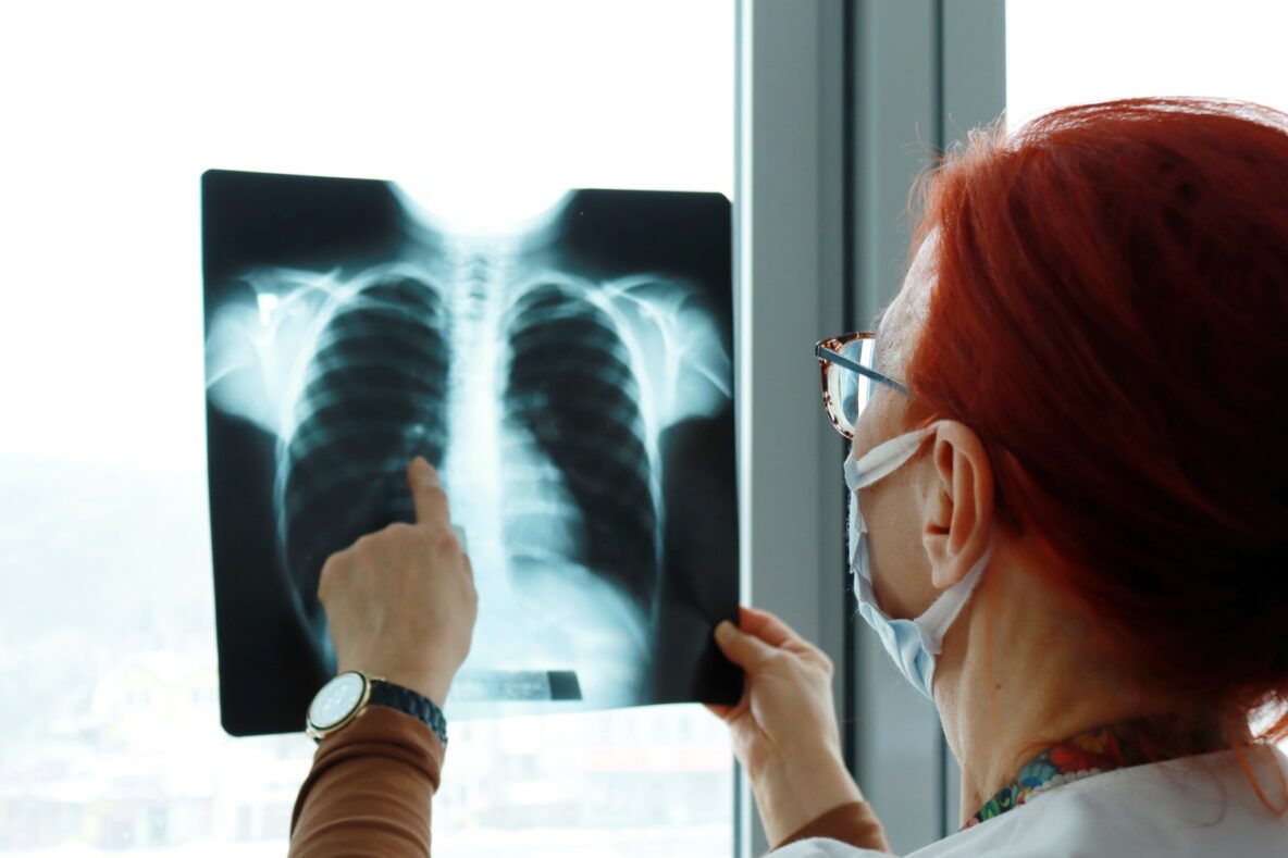 A doctor analyzes an x-ray of the child’s lungs.